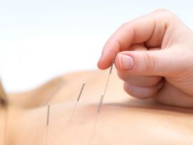 Acupuncture for Beginners