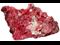 rhodonite