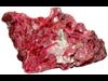 rhodonite