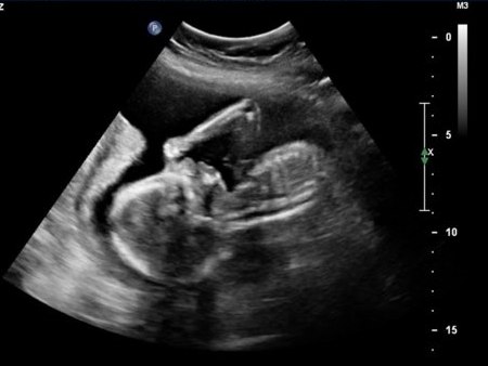 Slide Image